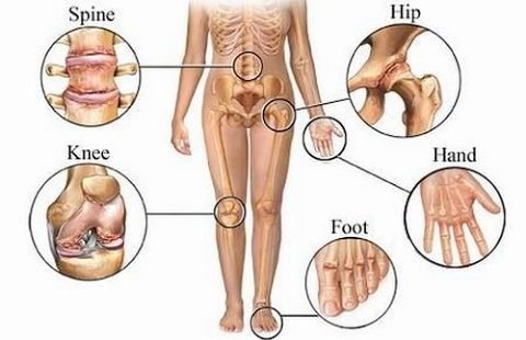 uric acid deposit locations in human body uric acid ke upay ilaj in ayurveda