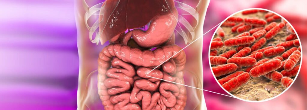 SIBO ke lakshan upchar ilaj